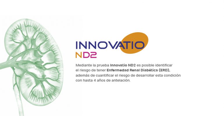 Innovatio ND2