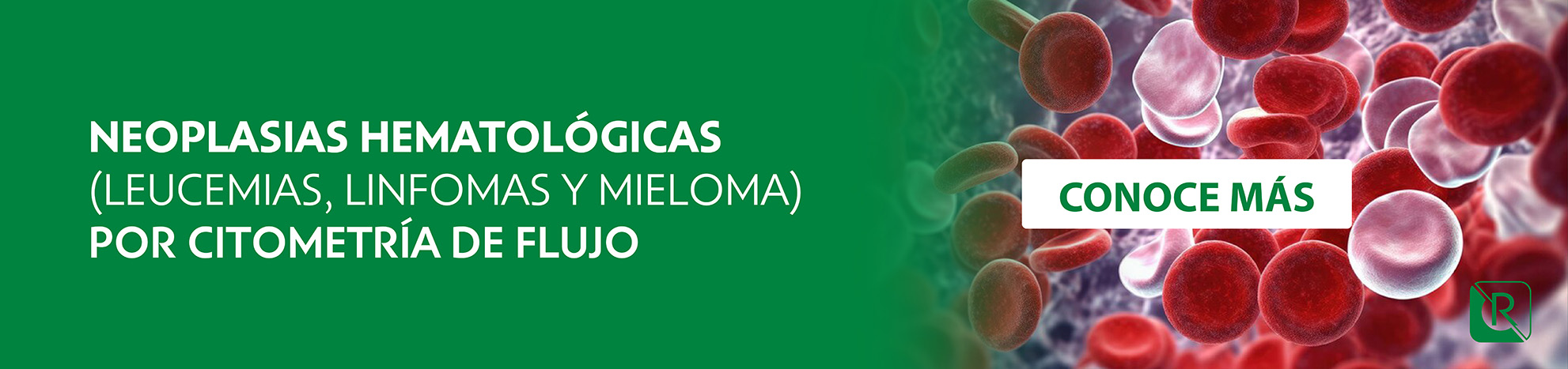 Neoplasias Hematológicas
