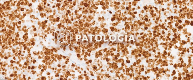 Patolog a Anat mica Y Molecular Referencia patolog-a-anat-mica-y-molecular-referencia